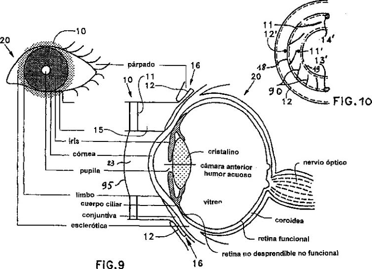Dispositivo de Iontoforesis Ocular